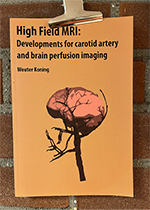ISBN: 9789088919770 - Title: High Field MRI: Developments for carotid artery and brain perfusion imaging